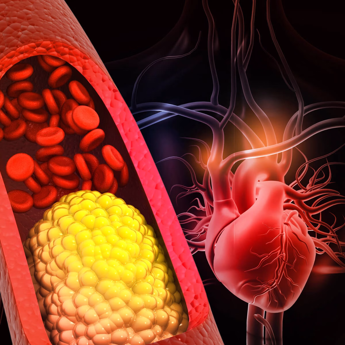 Principalele cauze de colesterol mărit